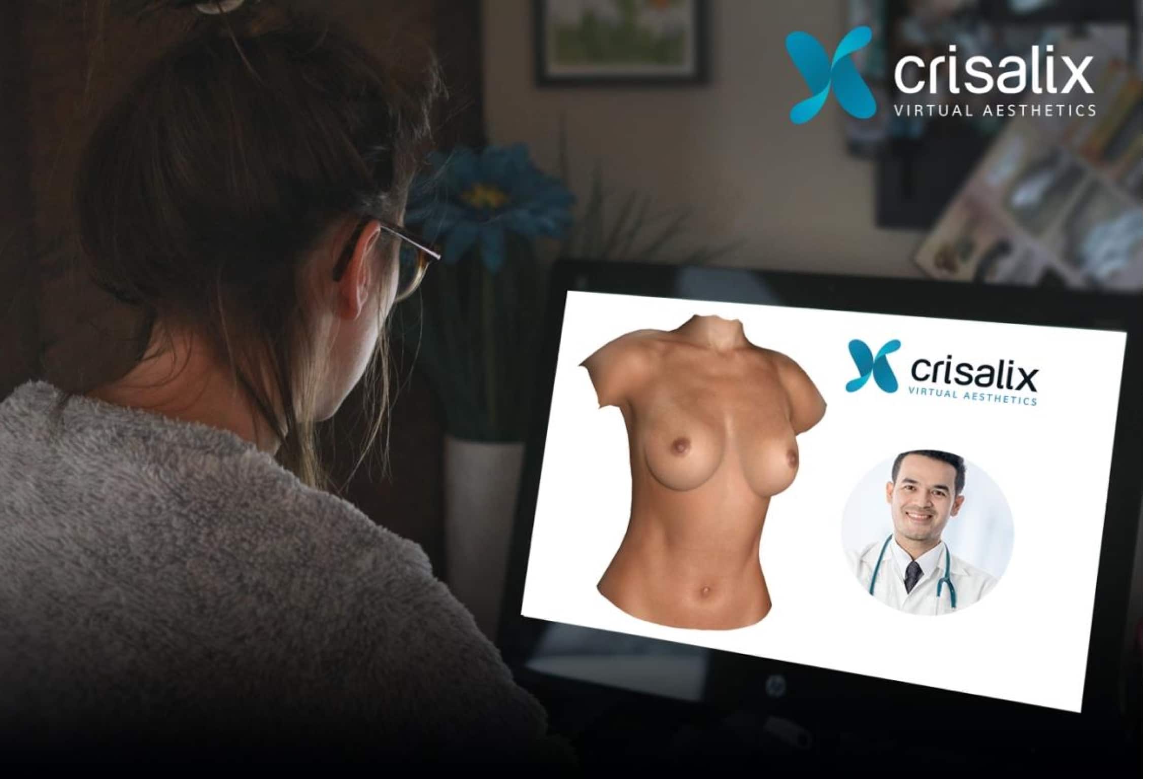 Simulation 3D Crisalix | Dr Nicolas Brault | Chirurgie esthétique | Paris